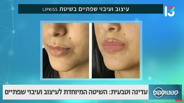 פיסול פנים למראה רענן וטבעי 